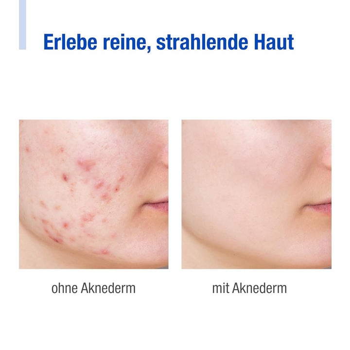 AKNEDERM Daily Cosmetic Set for sensitive skin, 230